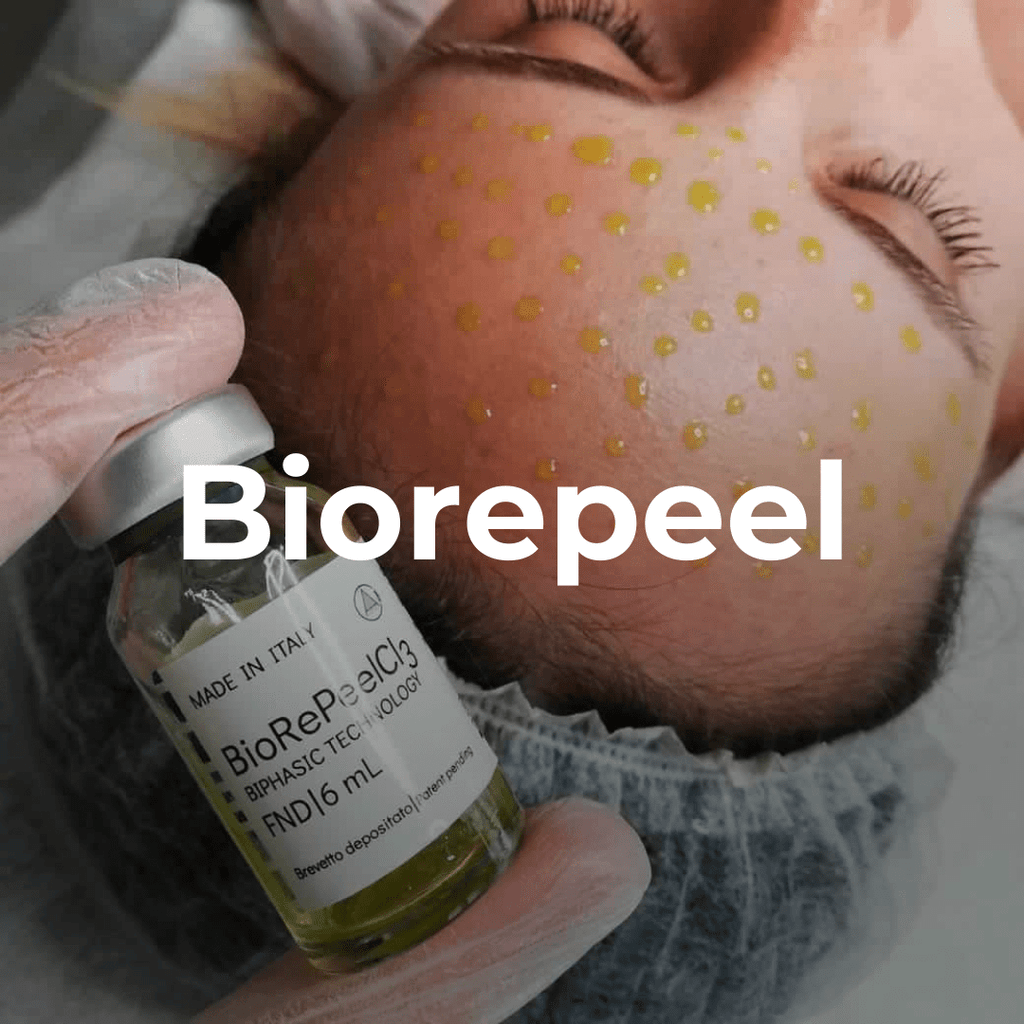 BioRePeel Chemical Peel - Monarch MD Medical Aesthetics