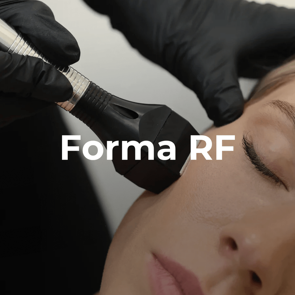 Forma RF Facial - Monarch MD Medical Aesthetics