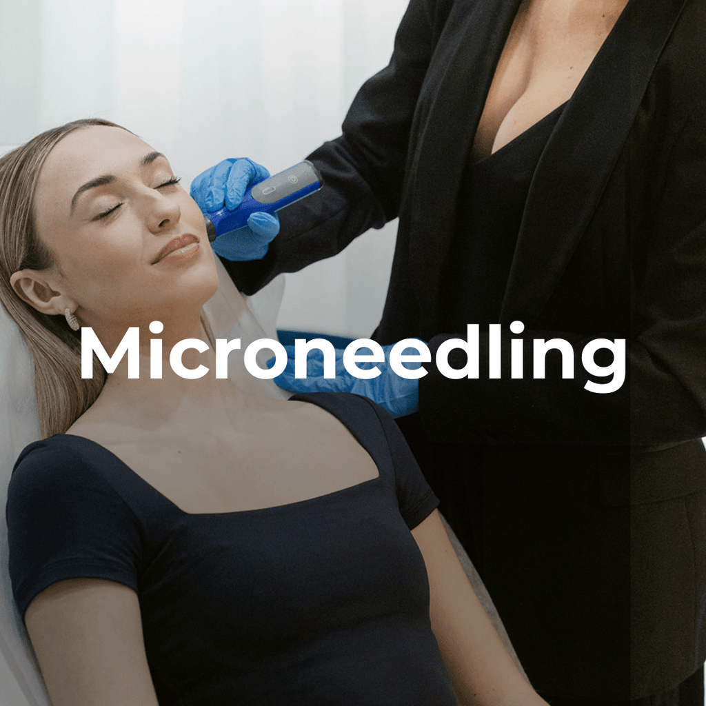 Microneedling - Monarch MD Medical Aesthetics