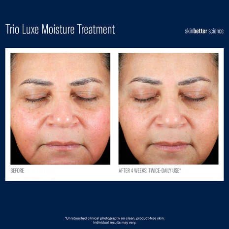 SkinBetter Science - Trio Luxe Moisture Treatment - Monarch MD Medical Aesthetics