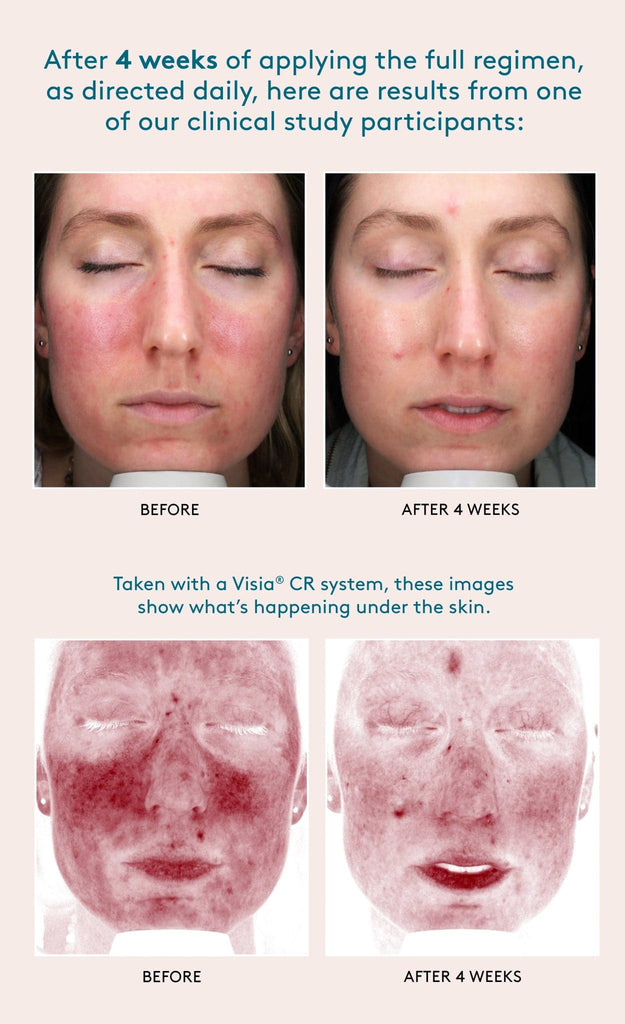 Colorescience All Calm Clinical Redness Corrector SPF 50 - Monarch MD Medical Aesthetics by Double Board Certified Facial Plastic Surgeon Dr. Eli Akbari MD, FRCSC