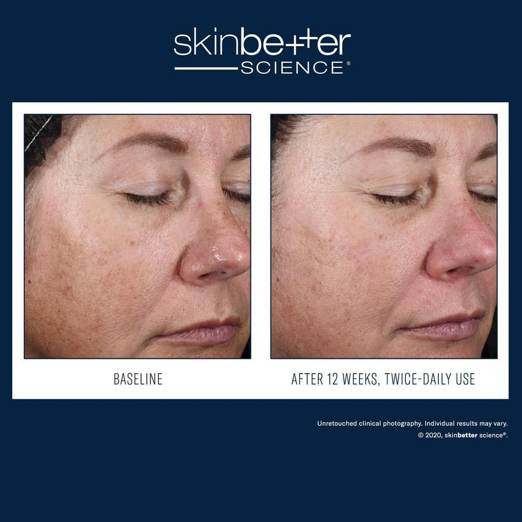 Skinbetter Science - Alto Advanced Defense and Repair - Monarch MD Medical Aesthetics by Double Board Certified Facial Plastic Surgeon Dr. Eli Akbari MD, FRCSC