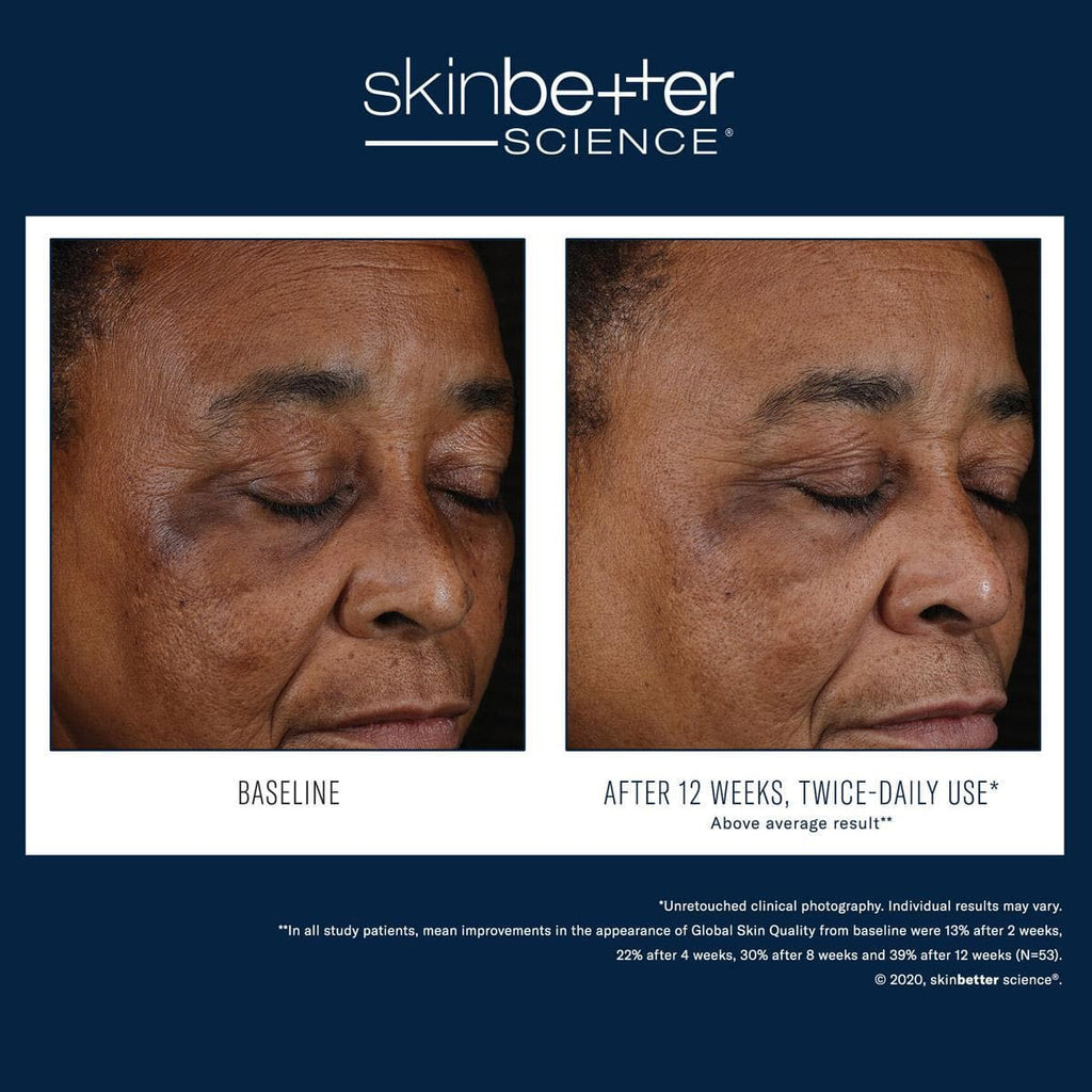 Skinbetter Science - Mystro Active Balance Serum - Monarch MD Medical Aesthetics by Double Board Certified Facial Plastic Surgeon Dr. Eli Akbari MD, FRCSC