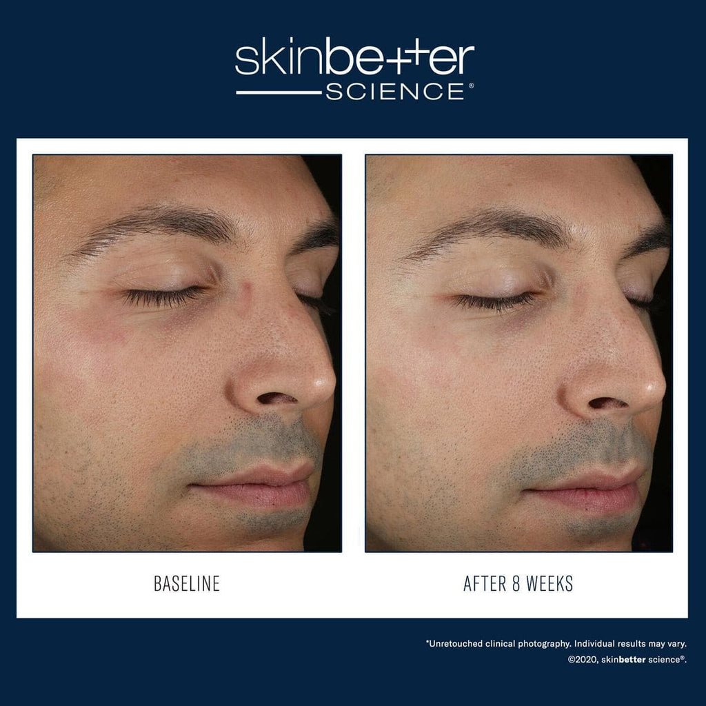 Skinbetter Science - Solo Hydrating Defense - Monarch MD Medical Aesthetics by Double Board Certified Facial Plastic Surgeon Dr. Eli Akbari MD, FRCSC