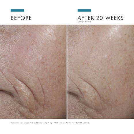 SkinCeuticals CE Ferulic - Monarch MD Medical Aesthetics by Double Board Certified Facial Plastic Surgeon Dr. Eli Akbari MD, FRCSC