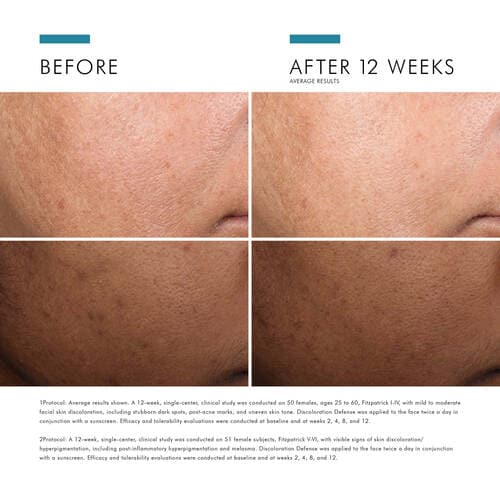 SkinCeuticals Discoloration Defense - Monarch MD Medical Aesthetics by Double Board Certified Facial Plastic Surgeon Dr. Eli Akbari MD, FRCSC