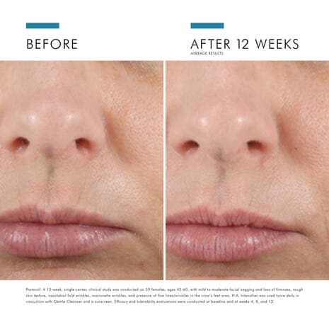 SkinCeuticals H.A. Intensifier - Monarch MD Medical Aesthetics by Double Board Certified Facial Plastic Surgeon Dr. Eli Akbari MD, FRCSC