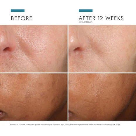 SkinCeuticals Phloretin CF - Monarch MD Medical Aesthetics by Double Board Certified Facial Plastic Surgeon Dr. Eli Akbari MD, FRCSC