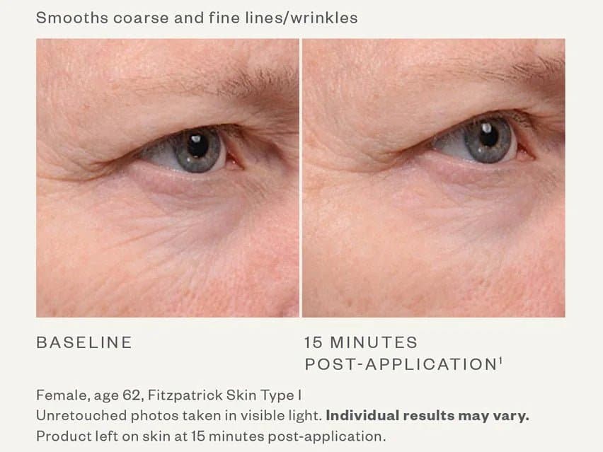 SkinMedica TNS Eye Repair - Monarch MD Medical Aesthetics by Double Board Certified Facial Plastic Surgeon Dr. Eli Akbari MD, FRCSC