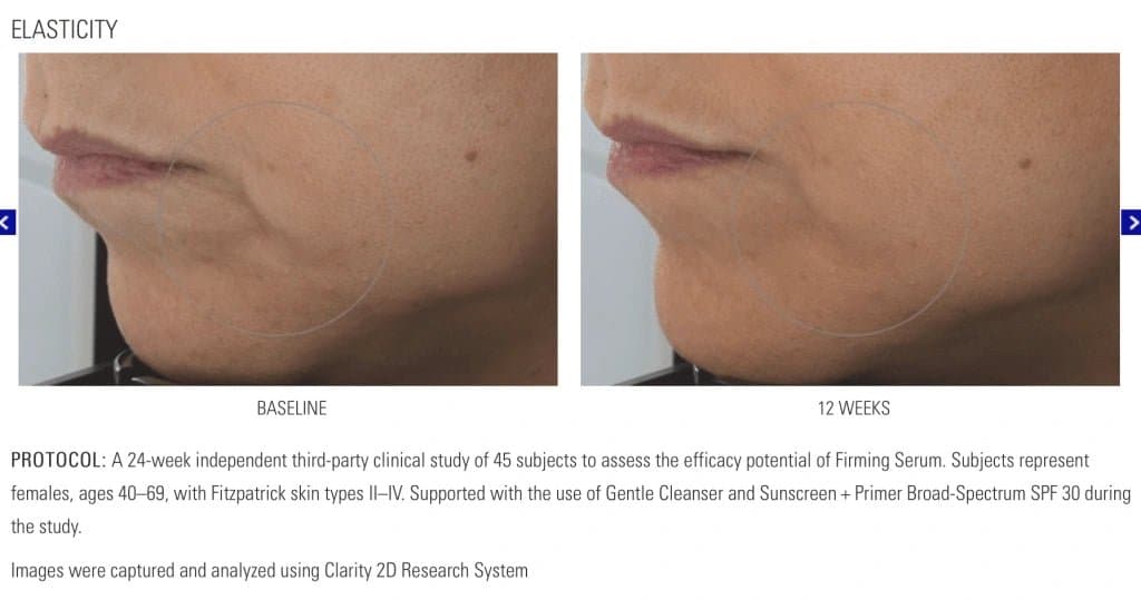 ZO Firming Serum – Monarch MD Medical Aesthetics