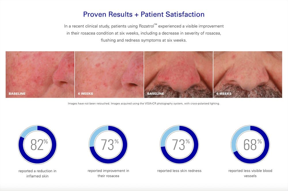 ZO Rozatrol - Monarch MD Medical Aesthetics by Double Board Certified Facial Plastic Surgeon Dr. Eli Akbari MD, FRCSC