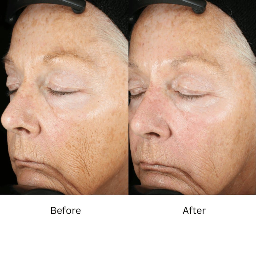 ZO Wrinkle and Texture Repair - Monarch MD Medical Aesthetics by Double Board Certified Facial Plastic Surgeon Dr. Eli Akbari MD, FRCSC